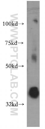 PIGA Antibody in Western Blot (WB)