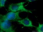 CHMP4B Antibody in Immunocytochemistry (ICC/IF)