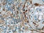 CHMP4B Antibody in Immunohistochemistry (Paraffin) (IHC (P))