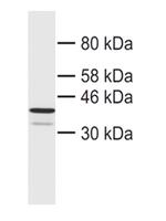 CHMP4B Antibody in Western Blot (WB)