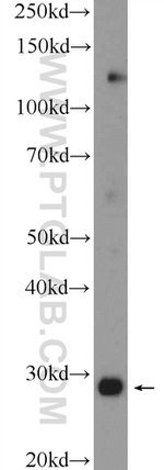 CHMP4B Antibody in Western Blot (WB)