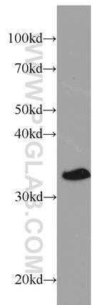 CHMP4B Antibody in Western Blot (WB)