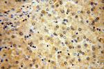 MTMR6 Antibody in Immunohistochemistry (Paraffin) (IHC (P))