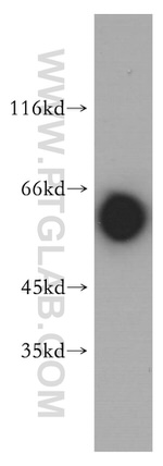 MTMR6 Antibody in Western Blot (WB)