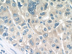 BCKDHB Antibody in Immunohistochemistry (Paraffin) (IHC (P))