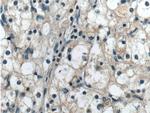 BCKDHB Antibody in Immunohistochemistry (Paraffin) (IHC (P))