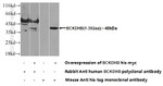 BCKDHB Antibody in Western Blot (WB)