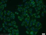 VEGFR-1/FLT-1 Antibody in Immunocytochemistry (ICC/IF)