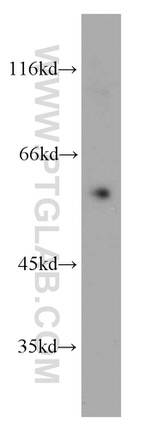 VEGFR-1/FLT-1 Antibody in Western Blot (WB)
