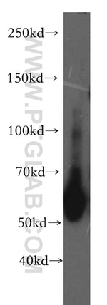 VEGFR-1/FLT-1 Antibody in Western Blot (WB)