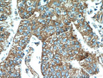 NEDD4L Antibody in Immunohistochemistry (Paraffin) (IHC (P))