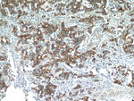 NEDD4L Antibody in Immunohistochemistry (Paraffin) (IHC (P))