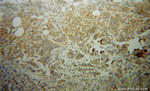 NEDD4L Antibody in Immunohistochemistry (Paraffin) (IHC (P))