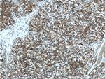 NEDD4L Antibody in Immunohistochemistry (Paraffin) (IHC (P))