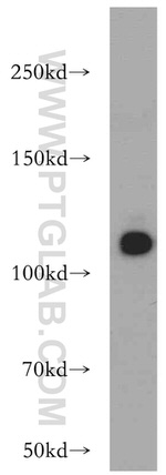 NEDD4L Antibody in Western Blot (WB)