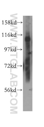 NEDD4L Antibody in Western Blot (WB)