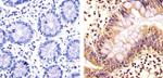 STAT3 Antibody in Immunohistochemistry (Paraffin) (IHC (P))