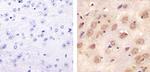 STAT3 Antibody in Immunohistochemistry (Paraffin) (IHC (P))