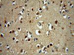 NPAS1 Antibody in Immunohistochemistry (Paraffin) (IHC (P))