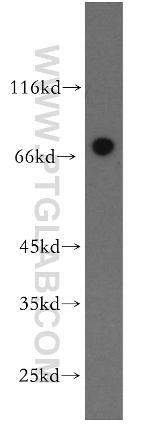 NPAS1 Antibody in Western Blot (WB)