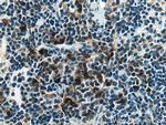 ADAP2 Antibody in Immunohistochemistry (Paraffin) (IHC (P))