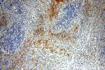 ADAP2 Antibody in Immunohistochemistry (Paraffin) (IHC (P))