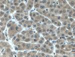 LARP1 Antibody in Immunohistochemistry (Paraffin) (IHC (P))