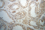 TCP10L Antibody in Immunohistochemistry (Paraffin) (IHC (P))