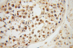 TCP10L Antibody in Immunohistochemistry (Paraffin) (IHC (P))