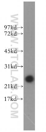 TCP10L Antibody in Western Blot (WB)