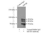 KIF2B Antibody in Immunoprecipitation (IP)