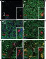 IL-13 Antibody in Immunohistochemistry (IHC)