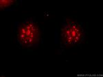 DMC1 Antibody in Immunocytochemistry (ICC/IF)