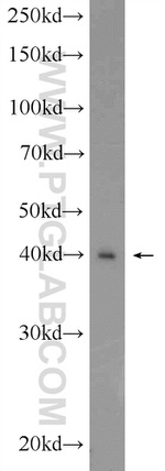 DMC1 Antibody in Western Blot (WB)