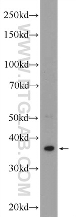 DMC1 Antibody in Western Blot (WB)