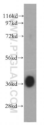 DMC1 Antibody in Western Blot (WB)