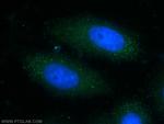 LSS Antibody in Immunocytochemistry (ICC/IF)