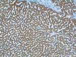 LSS Antibody in Immunohistochemistry (Paraffin) (IHC (P))