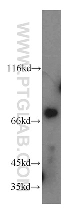 LSS Antibody in Western Blot (WB)