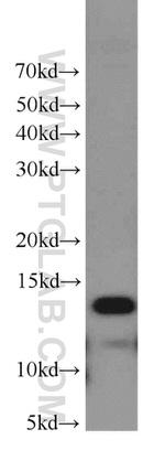 Phospholemman/FXYD1 Antibody in Western Blot (WB)