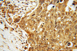 TTF2 Antibody in Immunohistochemistry (Paraffin) (IHC (P))