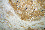 TTF2 Antibody in Immunohistochemistry (Paraffin) (IHC (P))