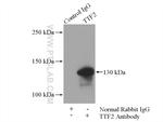 TTF2 Antibody in Immunoprecipitation (IP)