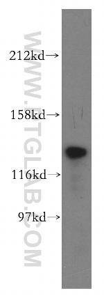 TTF2 Antibody in Western Blot (WB)