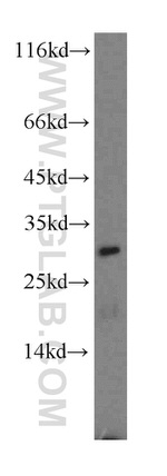 CBR4 Antibody in Western Blot (WB)