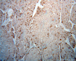 AUP1 Antibody in Immunohistochemistry (Paraffin) (IHC (P))