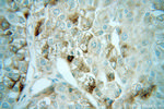 AUP1 Antibody in Immunohistochemistry (Paraffin) (IHC (P))