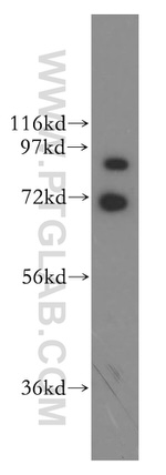 GRK3 Antibody in Western Blot (WB)