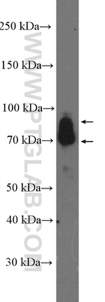 GRK3 Antibody in Western Blot (WB)