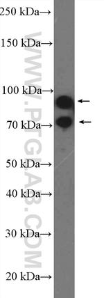 GRK3 Antibody in Western Blot (WB)